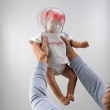 SÍNDROME DO BEBÊ SACUDIDO: UM ALERTA QUE PODE SALVAR VIDAS